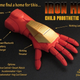 Illustration for article titled Artificial emIron Man/em Hand Makes Kids Feel Like Tony Stark